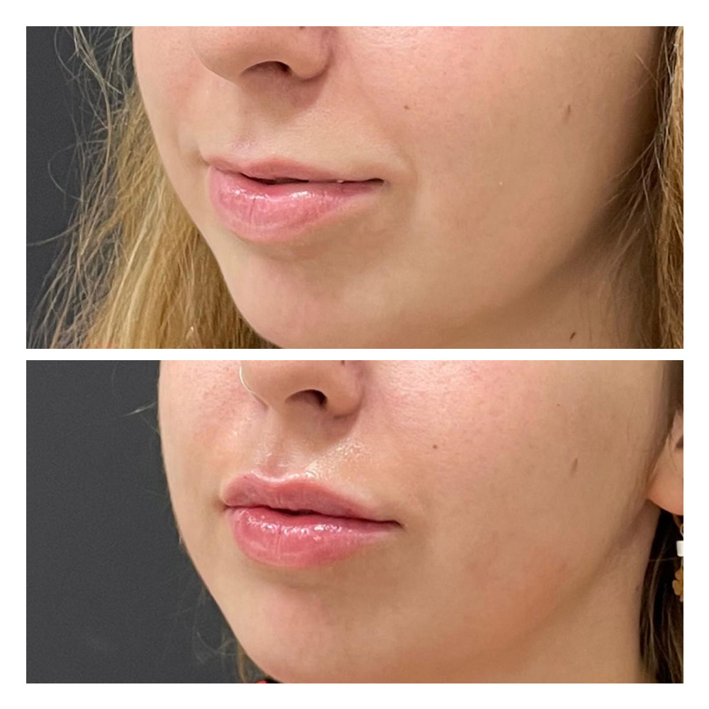 g10 Foto paciente 10 de estética facial