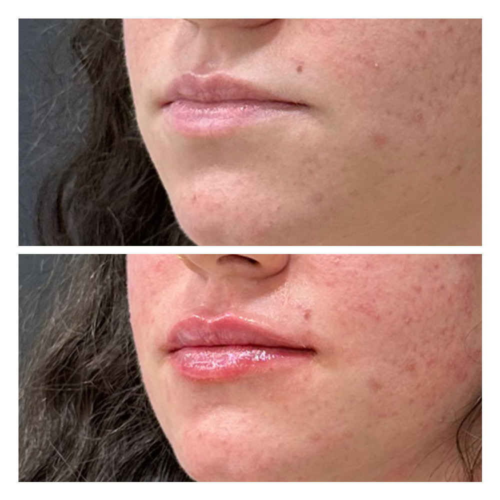 g11 Foto paciente 11 de estética facial