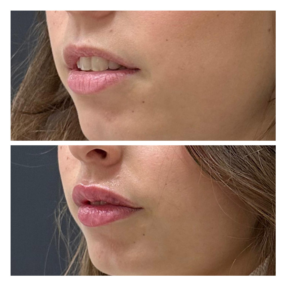 g12 Foto paciente 12 de estética facial