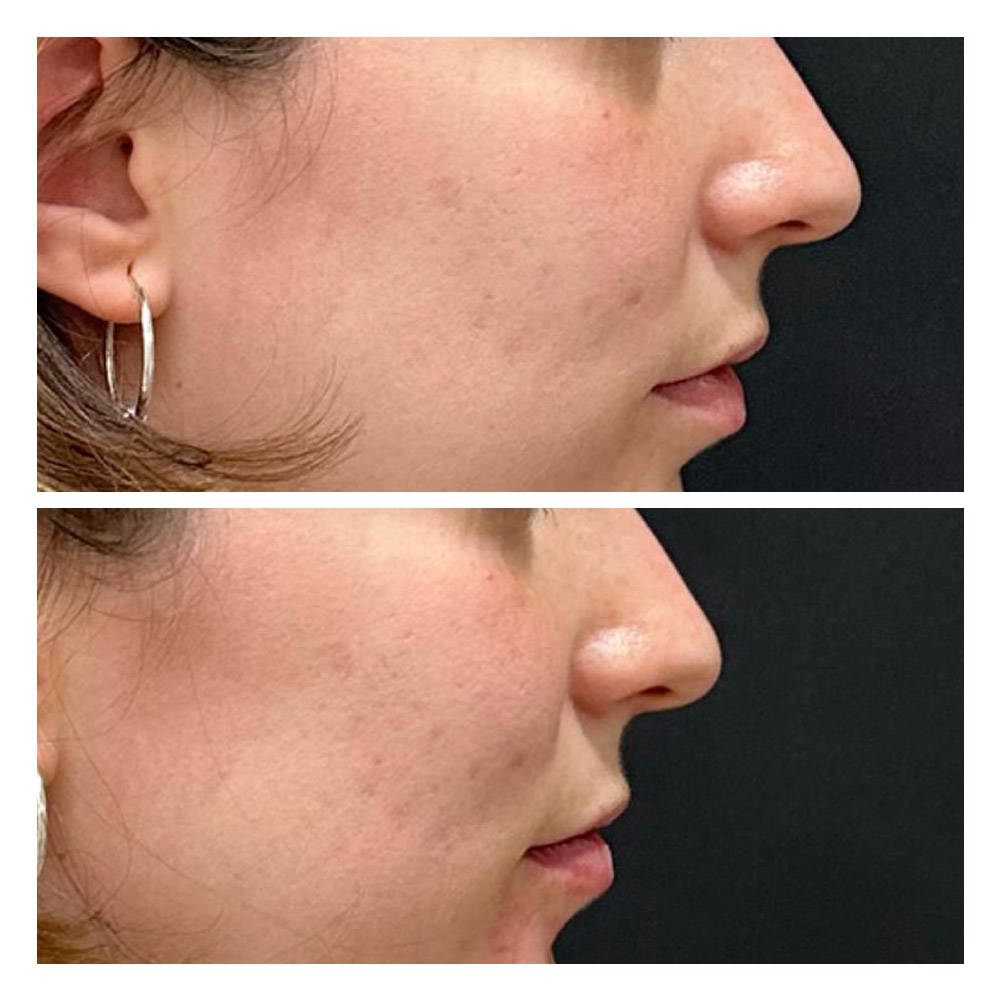 g13 Foto paciente 13 de estética facial