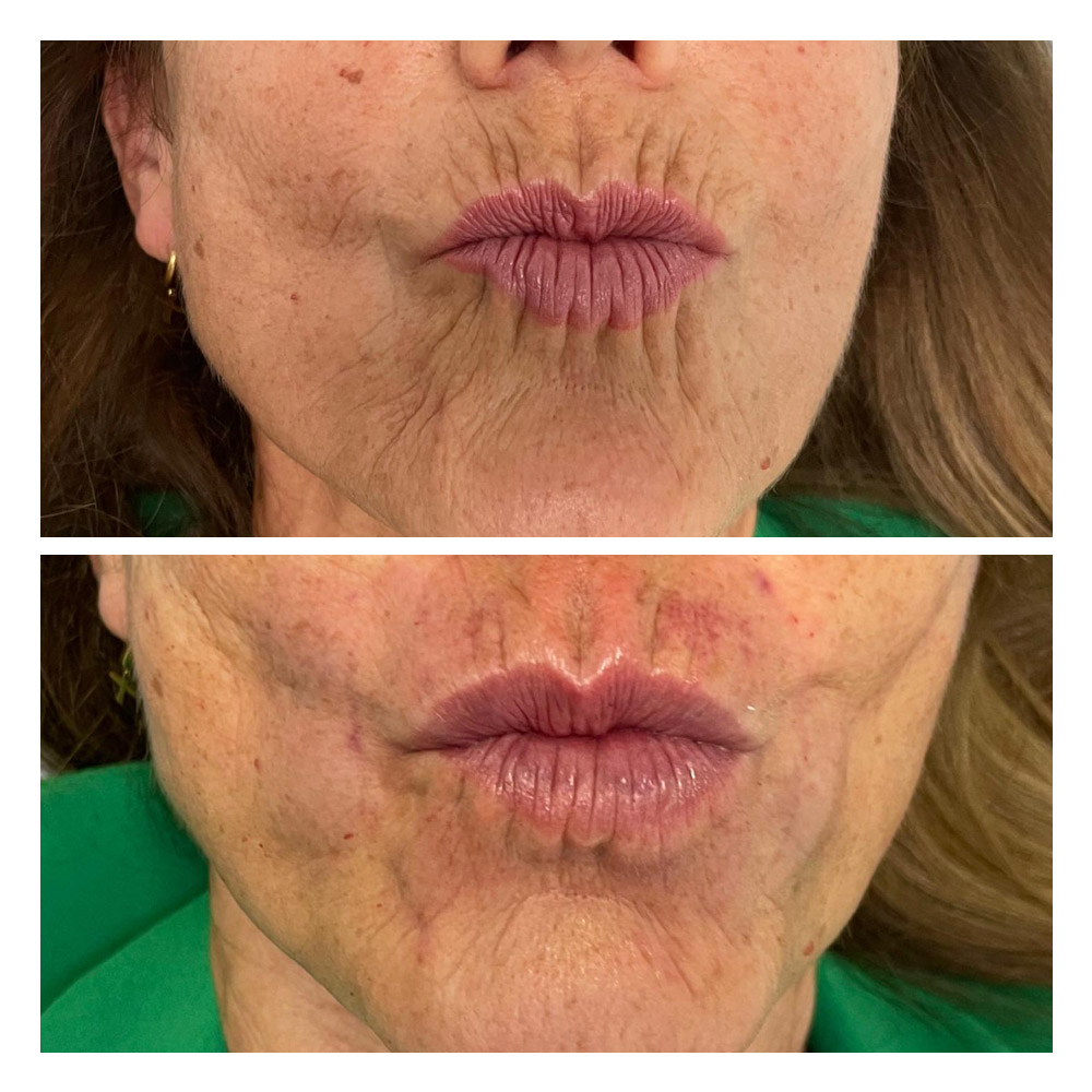 g14 Foto paciente 14 de estética facial