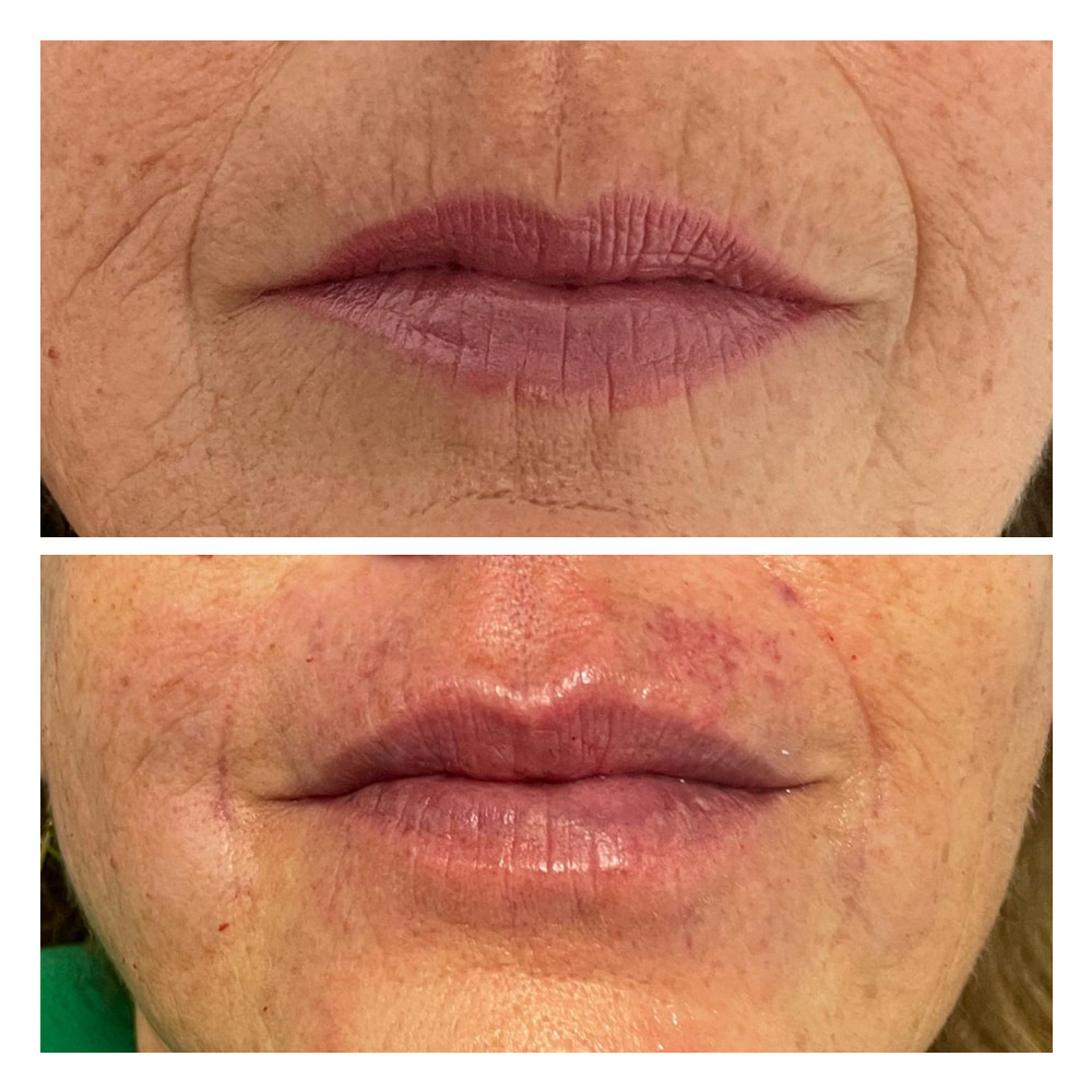 g7 Foto paciente 7 de estética facial