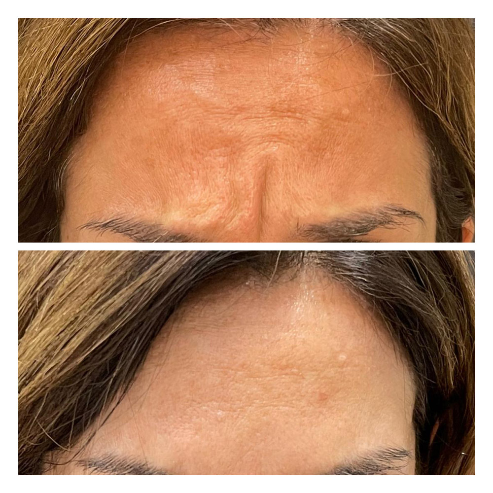 g8 Foto paciente 8 de estética facial