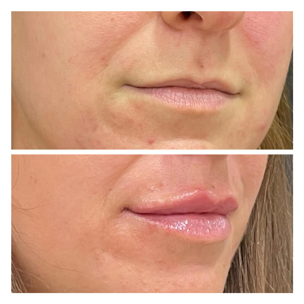 g9 Foto paciente 9 de estética facial