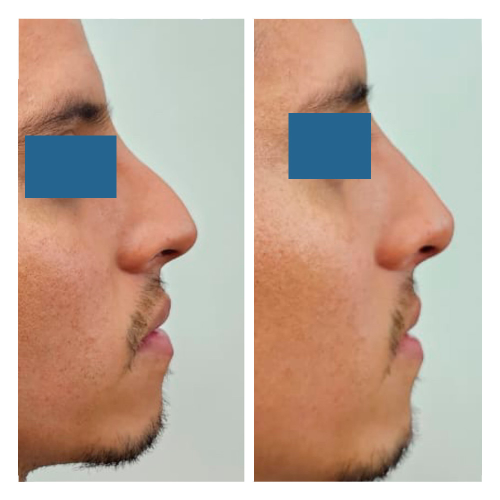g17 Foto casos reales paciente 3